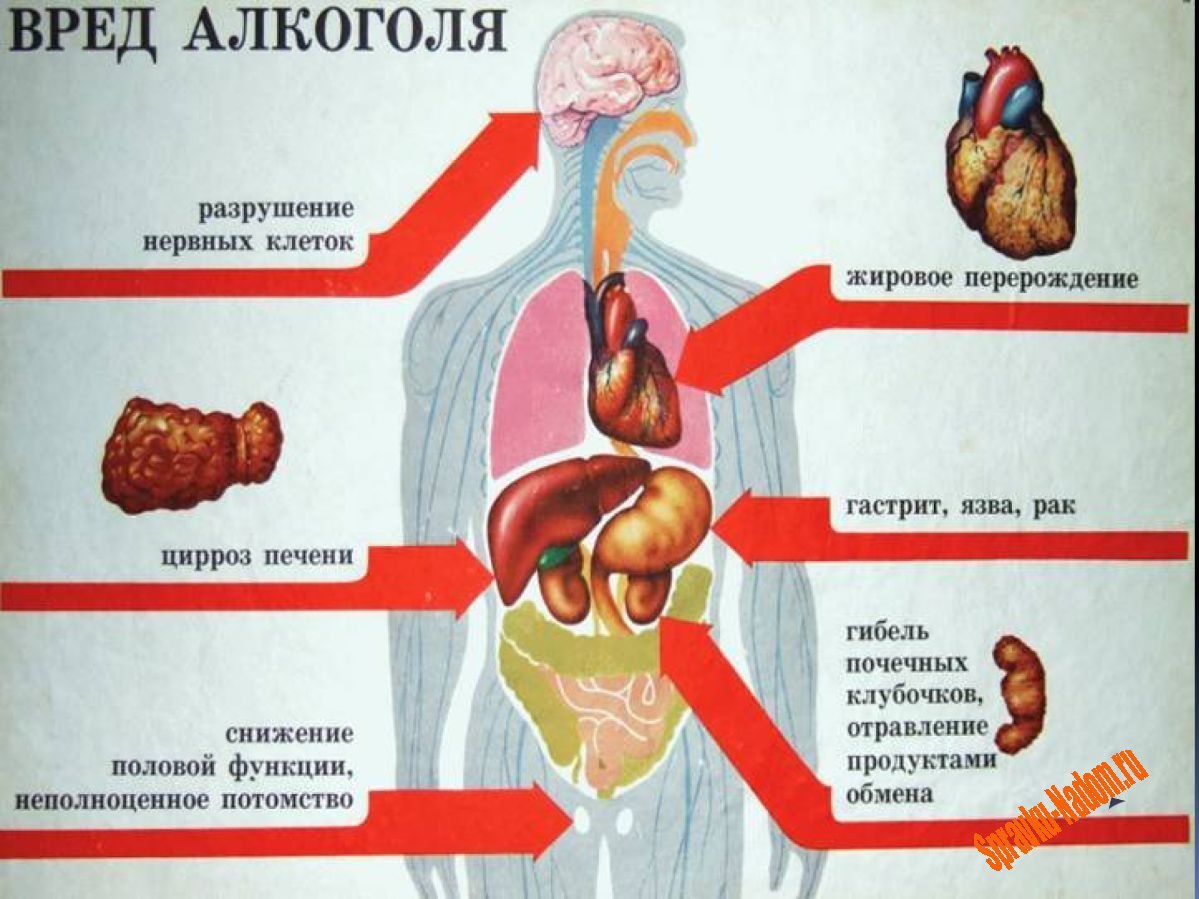 вред алкоголя 